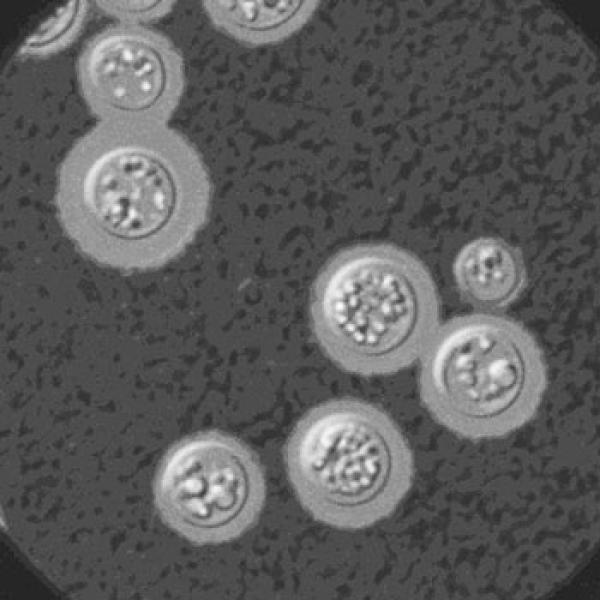 cryptococcus fungus in petri dish